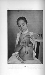 Fig. 9 - Concours d'agrégation des facultés de médecine, 1904, section de chirurgie et d'accouchemen [...]