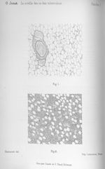 Fig. 1. Moelle osseuse normale d'homme / Fig. 2. Coupe de moelle proliférée d'homme - Exposé des tit [...]