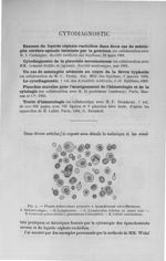 Fig. 7. Pleuro-tuberculose primaire à épanchement séro-fibrineux - Exposé des titres et travaux scie [...]