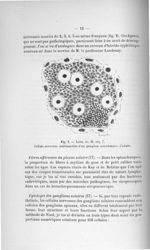 Fig. 2. Leitz, oc. II, obj. 7. Cellule nerveuse multinucléée d'un ganglion semi-lunaire d'adulte - E [...]