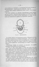 Fig. 10. Myélocystocèle - Titres et travaux scientifiques
