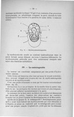 Fig. 11. Myélocystoméningocèle - Titres et travaux scientifiques