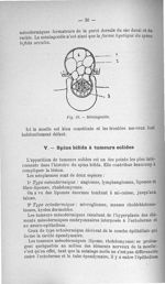 Fig. 12. Méningocèle - Titres et travaux scientifiques