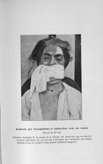 Asphyxie par étranglement et suffocation avec les mains - Décembre 1903. Exposé des titres et travau [...]