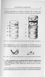 Fig. 2 et 3. Face antérieure des corps des 4 premières vertèbres lombaires / Fig. 4 et 5. La vertèbr [...]