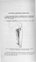 Fig. 37. Faisceau accessoire (M. acc) du muscle couturier, détaché du pectiné au voisinage de son in [...]