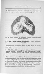 Fig. 38. Face inférieure du diaphragme. Faisceaux charnus anormaux unissant les folioles - Titres et [...]