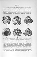 Fig. 22. Crâne (grandeur naturelle) - Titres et travaux scientifiques