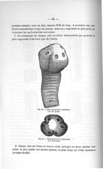 Fig. 30. Tête munie de 6 ventouses, vue de profil / Fig. 31. Tête munie de 6 ventouses, vue d'en hau [...]