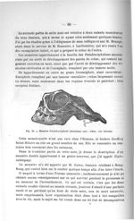 Fig. 36. Monstre Pseudencéphale (deuxième cas) - Titres et travaux scientifiques