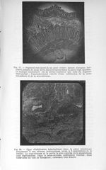 Fig. 11. Segment sus-jacent à un anus contre nature d'origine herniaire, datant de deux mois / Fig.  [...]