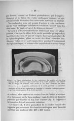 Figure 5. Figure représentant la face antérieure du modèle en cire d'un embryon de 207 heures - Titr [...]