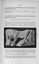 Figure 9. Moulage des canaux pleuro-péricardiques et d'une partie des cavités péricardique et pleura [...]
