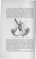 Fig. 18. Dissection du bout antérieur de l'urèthre - Titres et travaux scientifiques