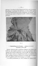 Fig. 3 - Concours d'agrégation de chirurgie et d'accouchements, 1904. Exposé des titres et travaux s [...]