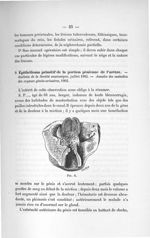 Fig. 8 - Concours d'agrégation de chirurgie et d'accouchements, 1904. Exposé des titres et travaux s [...]