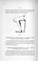 Fig. 11 - Concours d'agrégation de chirurgie et d'accouchements, 1904. Exposé des titres et travaux  [...]