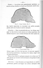 Fig. 3. Coupe frontale (Obs. V) / Fig. 4. Coupe frontale (Obs. ) - Exposé des titres et travaux scie [...]