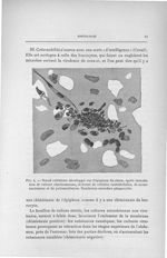 Fig. 4. Noeud cellulaire développé sur l'épiploon du chien, après inoculation de culture charbonneus [...]