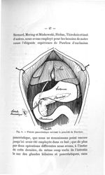 Fig. 8. Fistule pancréatique suivant le procédé de Pawlow - Titres et travaux scientifiques