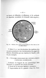 Fig. 12. Schéma d'un examen microscopique de fèces dans un cas de déficit biliaire - Titres et trava [...]