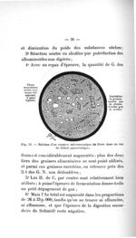 Fig. 13. Schéma d'un examen microscopique de fèces dans un cas de déficit pancréatique - Titres et t [...]