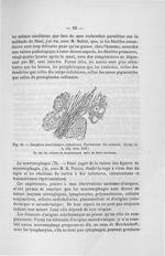Fig. 11. Ganglion semi-lunaire infectieux. Pneumonie du sommet - Addenda aux titres scientifiques