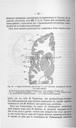 Fig. 13. Coupe horizontale passant par le bord inférieur du genou et du bec du corps calleux - Adden [...]