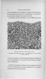 Myocarde dans un cas d'infarctus récent - Concours d'agrégation, 1906, Titres et travaux