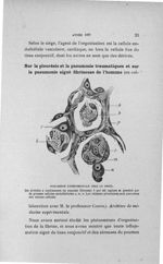 Pneumonie expérimentale chez le chien - Concours d'agrégation, 1906, Titres et travaux