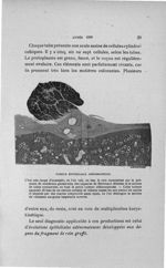 Tumeur épithéliale adénomateuse - Concours d'agrégation, 1906, Titres et travaux