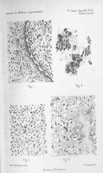 Fig 1. Coupe du mamelon 25 jours après l'inoculation d'un liquide de pleurésie purulente / Fig. 2. P [...]