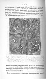 Fig. 2. Évolution caséeuse très marquée de la mamelle - Exposé des titres et travaux scientifiques