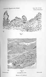 Fig. 1. Surface de la caduque et insertion des villosités (placenta de six mois) / Fig. 2. Pénétrati [...]