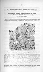 Fig. 7. Coupe du foie d'un foetus de cobaye long de 25 millimètres - Exposé des titres et travaux sc [...]