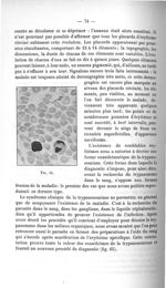 Fig. 14. [Prypanosome dans le sang] - Exposé des titres et travaux scientifiques