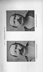 Fig. 16. Hémispasme facial vrai - Titres et travaux scientifiques