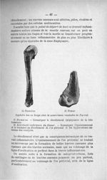 Syphilis des os longs chez le nourrisson (maladie de Parrot) - Titres et travaux scientifiques
