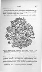 Fig. 7. Néphrite suraiguë expérimentale (Castaigne et Rathery) - Exposé des titres et travaux scient [...]