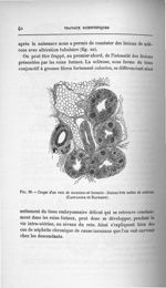 Fig. 20. Coupe d'un rein de nouveau-né humain : lésions très nettes de sclérose (Castaigne et Rather [...]