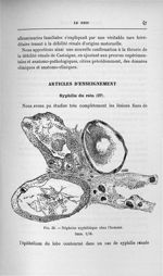 Fig. 23. Néphrite syphilitique chez l'homme - Exposé des titres et travaux scientifiques