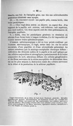 Fig. 1. Coupe transversale de la rétine de l'oeil droit - Exposé des titres et travaux scientifiques