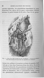 Fig. 1. Coeur d'un chien inoculé par voie carotidienne - Titres et travaux scientifiques