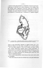 Fig. 1. Cerveau droit - Exposé des titres et des travaux scientifique, janvier 1907