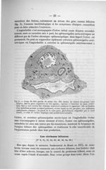 Fig. 2. Coupe du lobe gauche du même foie - Exposé des titres et travaux scientifiques, janvier 1907