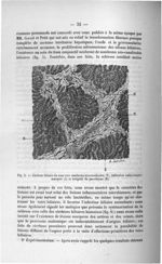 Fig. 5. Cirrhose biliaire du veau avec nombreux néo-canalicules (N), infiltration embryonnaire marqu [...]