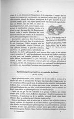 Fig. 14. Coupe du lobe droit du foie dans un cas de splénomégalie méta-ictérique - Exposé des titres [...]