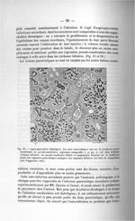 Fig. 15. Angio-pancréatite diabétigène - Exposé des titres et travaux scientifiques, janvier 1907