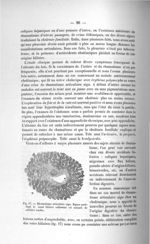 Fig. 17. Rhumatisme articulaire aigu - Exposé des titres et travaux scientifiques, janvier 1907