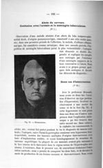 Fig. 21. Hémicraniose - Exposé des titres et travaux scientifiques, janvier 1907